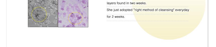 She just adopted ”right method of cleansing”everyday for 2 weeks.