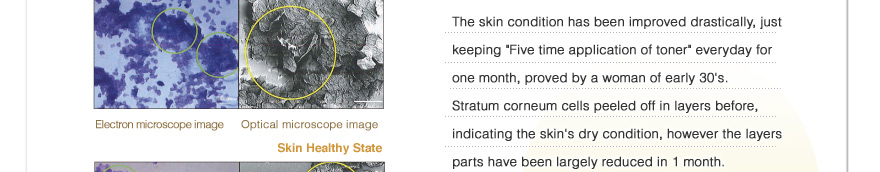 The skin condition has been improved drastically, just keeping Five time application of toner everyday for one month. Stratum corneum cells peeled off in layers before, 
indicating the skins dry condition, however the layers parts have been largely reduced in 1 month.